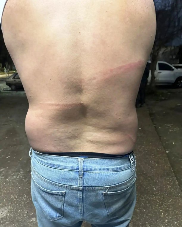 Pareja denunció agresión y robo de llave de auto por parte de patovicas en un boliche de Tucumán