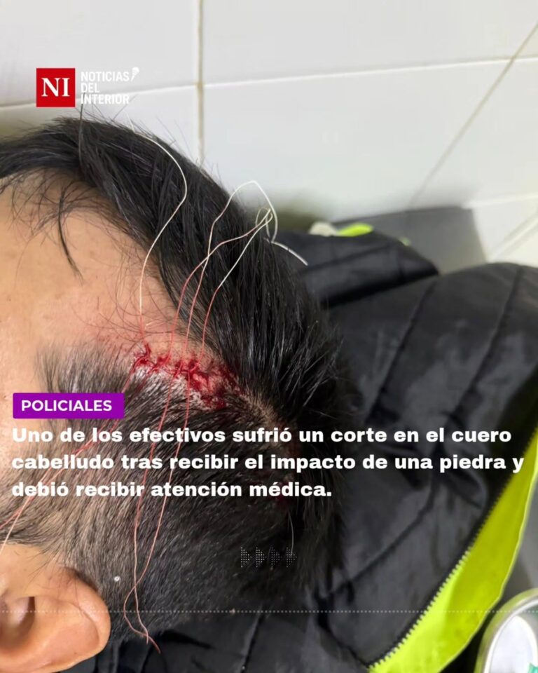 Móvil de la Guardia Urbana Municipal con ventanilla destruida tras ataque en Alberdi